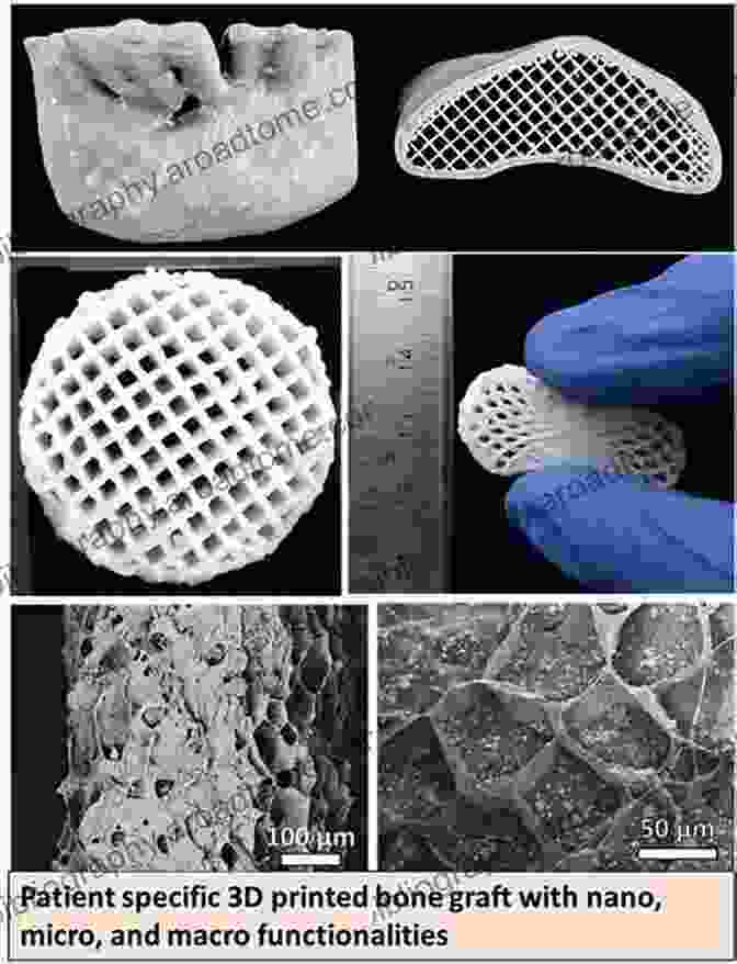 3D Printed Scaffold For Tissue Engineering And Regenerative Medicine Bone Tissue Engineering: Bench To Bedside Using 3D Printing