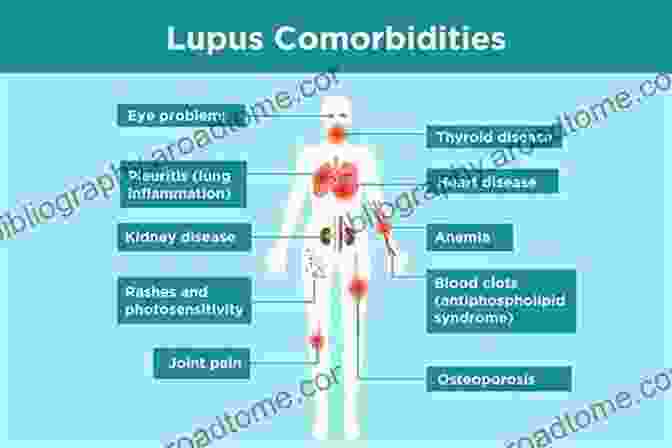 Diagram Explaining Lupus And Its Dietary Needs The Awesome Lupus Diet Cookbook And Meal Plan For Novices And Dummies