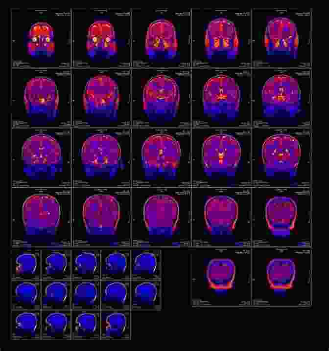 Functional Magnetic Resonance Imaging (fMRI),A Modern Tool For Studying Brain Activity During Memory Tasks Marking The Mind: A History Of Memory