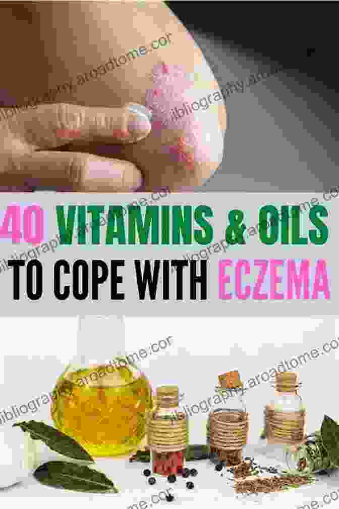 Natural Eczema Treatment Guide Cover Featuring A Woman With Clear, Healthy Skin And A Natural Remedies Backdrop Natural Eczema Treatment Guide : How To Get Rid Of Eczema Forever Using Natural Eczema Treatments And Diet Recipes