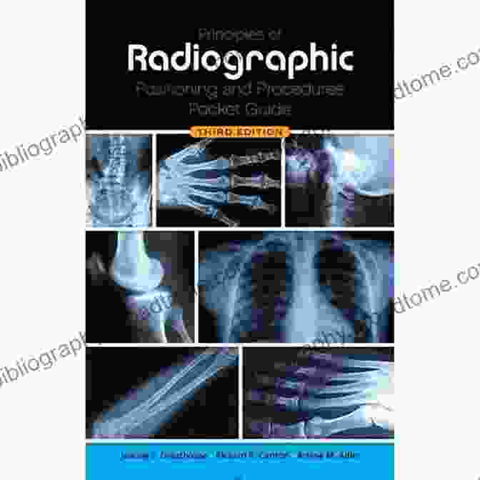 Principles Of Radiographic Positioning Bontrager S Handbook Of Radiographic Positioning And Techniques E