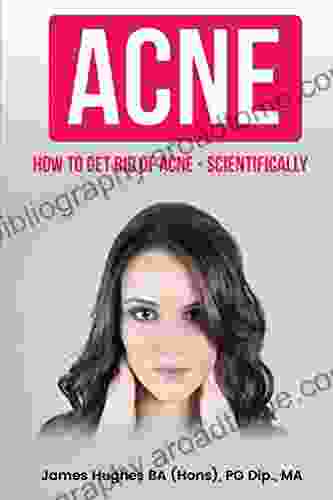 Acne: How To Get Rid Of Acne Scientifically