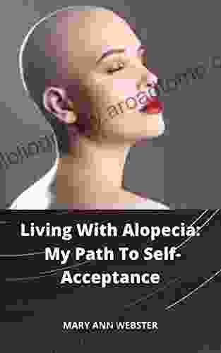 Living With Alopecia: My Path To Self Acceptance