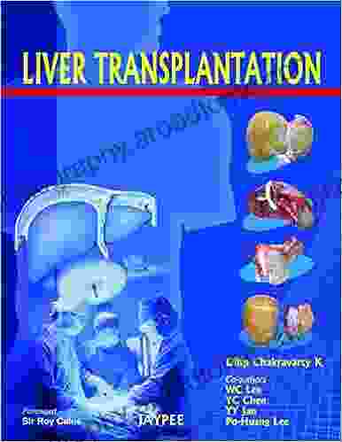 Liver Transplantation John Davidson