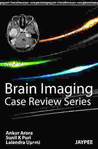 Brain Imaging: Case Review